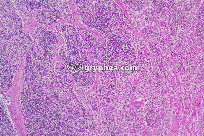 Ganglion lymphatique x25 - gryphea.org
